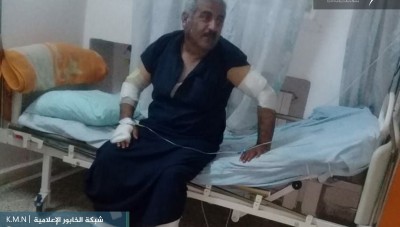 حرائق المحاصيل الزراعية تصيب 5 أشخاص في رأس العين