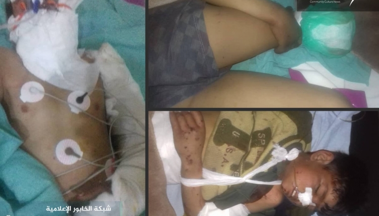 إصابة ثلاثة أطفال بانفجار لغم في جبل عبدالعزيز بالحسكة