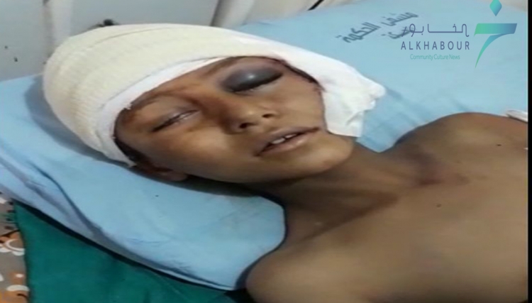 إصابة طفل بقصف طيران التحالف في بلدة مركدة جنوب الحسكة